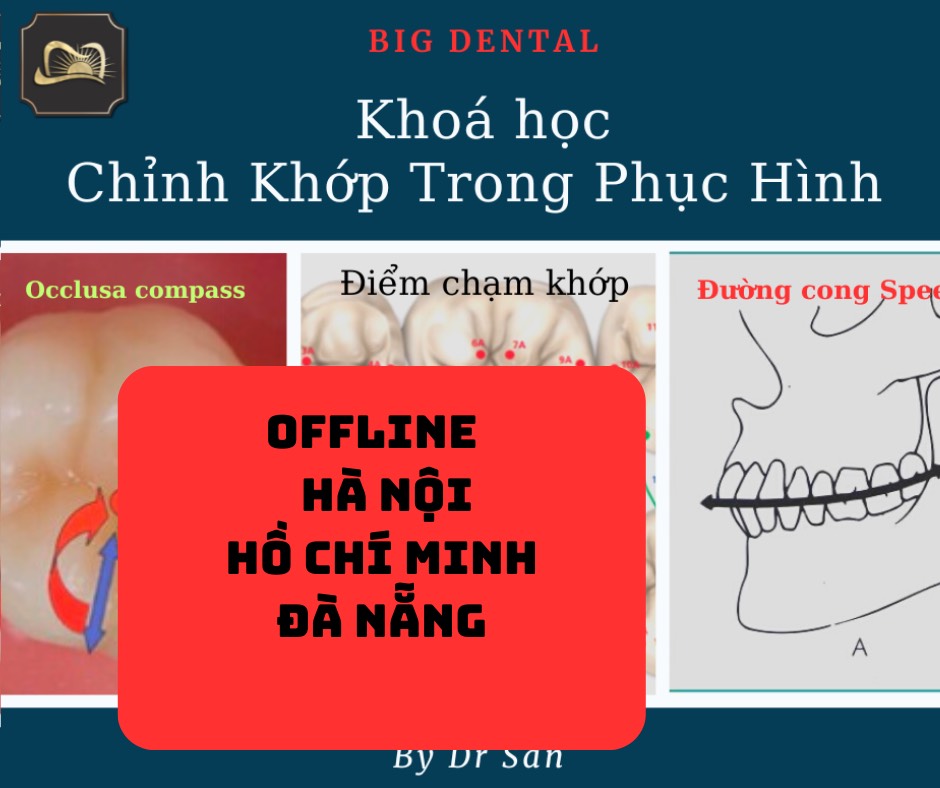 Khóa học offline về Chỉnh Khớp trong phục hình cố định