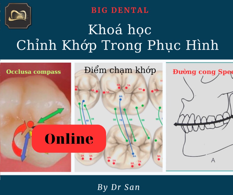 Khóa học online về Chỉnh Khớp trong phục hình cố định